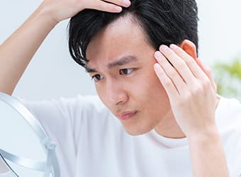 AGAとは?何が原因?