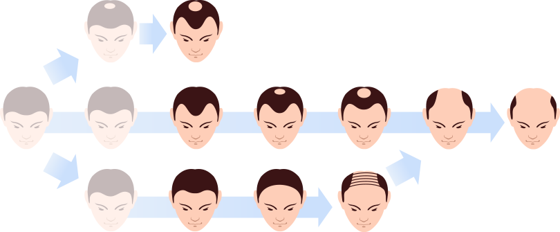 PLAN2 しっかり生やしたい方